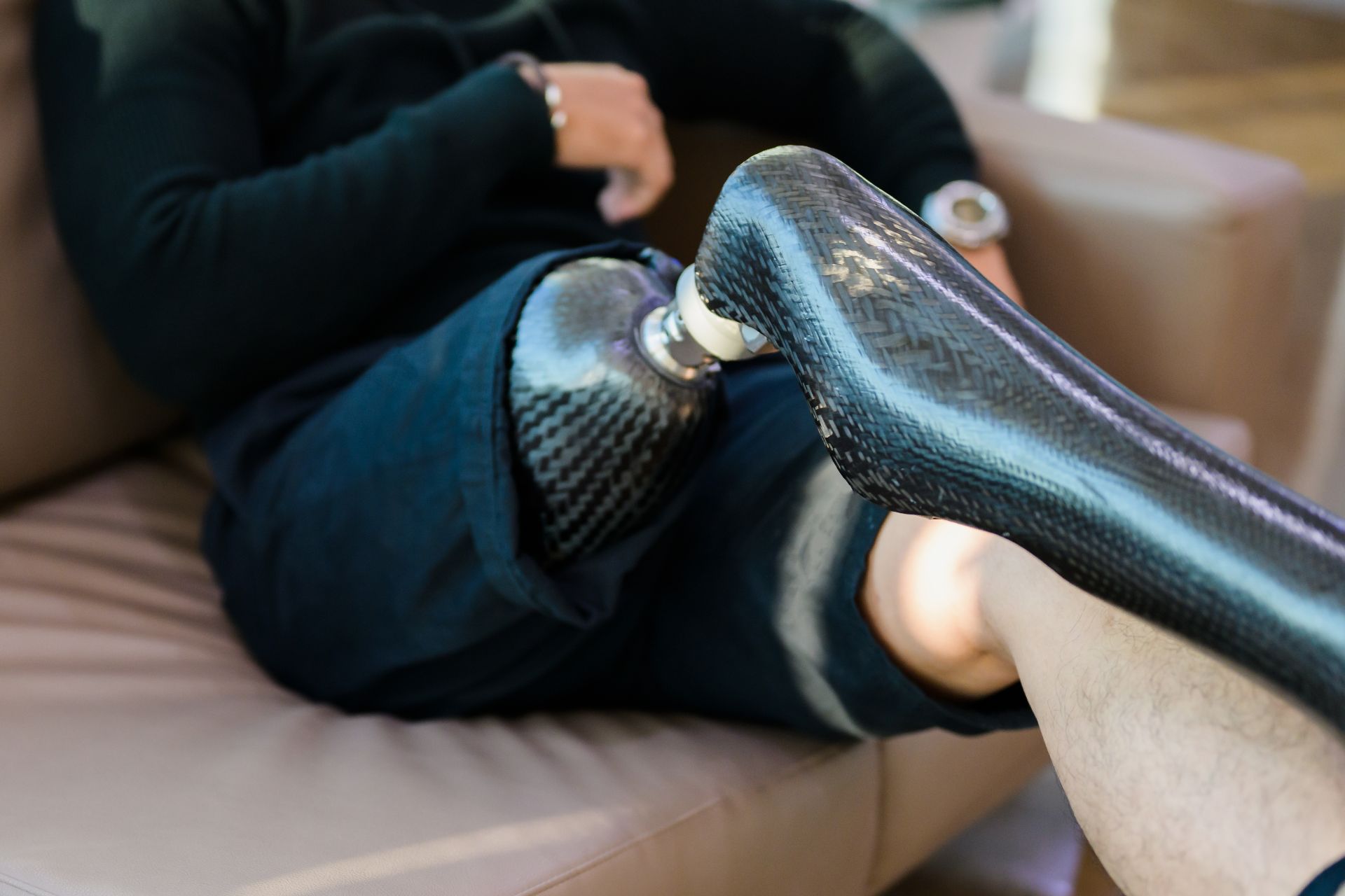 Карбон, титан, сталь, алюминий в протезировании